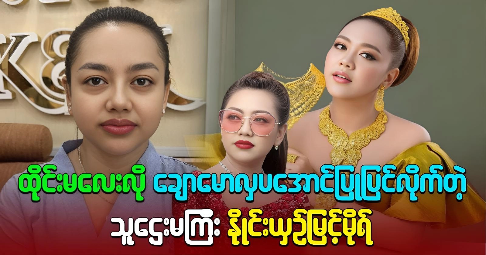 Actor Nhying Shin Myint Mo, transformed into a beautiful person, is compared. 